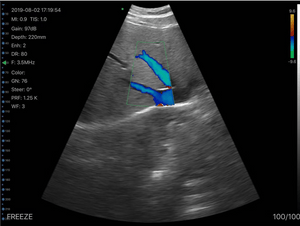 C10MT Convex Hand-Held Ultrasound