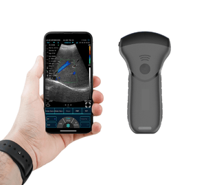 C10MT Convex Hand-Held Ultrasound