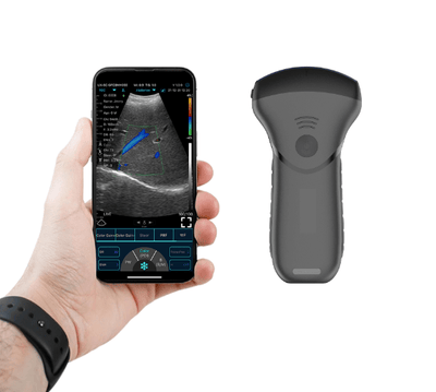 C10MT USB&Wifi Convex Abdominal Hand-Held Ultrasound