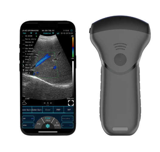 C10MT USB&Wifi Convex Abdominal Hand-Held Ultrasound