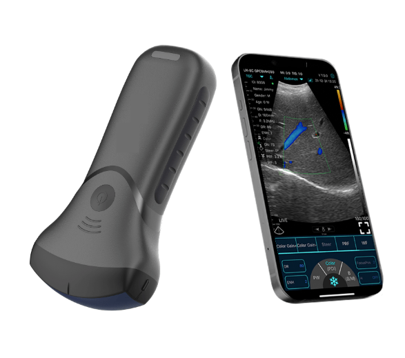 C10MT USB&Wifi Convex Abdominal Hand-Held Ultrasound