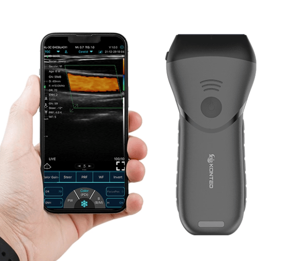 C10MX Linear Hand-Held WiFi & USB Ultrasound