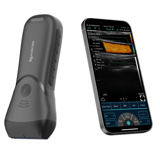 C10MX Linear Hand-Held WiFi & USB Ultrasound