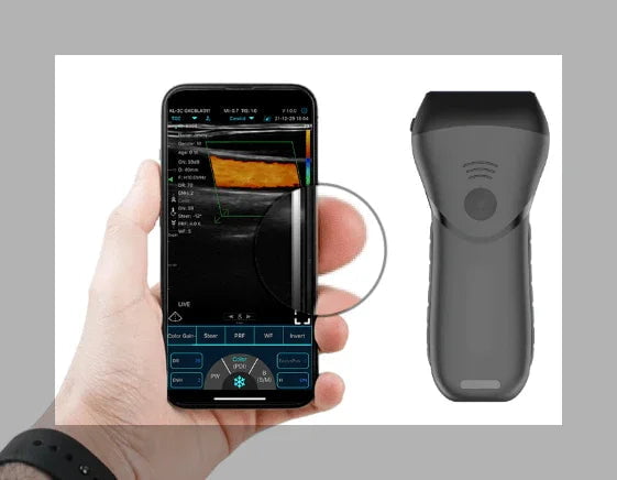 C10MX PRO B&W/Colour Superficial Linear Hand-Held Ultrasound