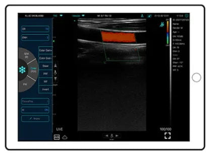 C10MX PRO B&W/Colour Superficial Linear Hand-Held Ultrasound