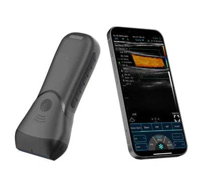 C10MX PRO B&W/Colour Superficial Linear Hand-Held Ultrasound