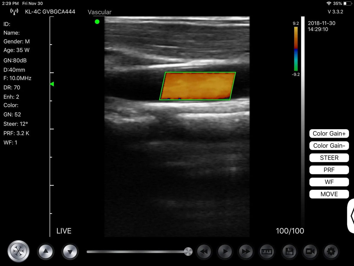 C10MX PRO B&W/Colour Superficial Linear Hand-Held Ultrasound