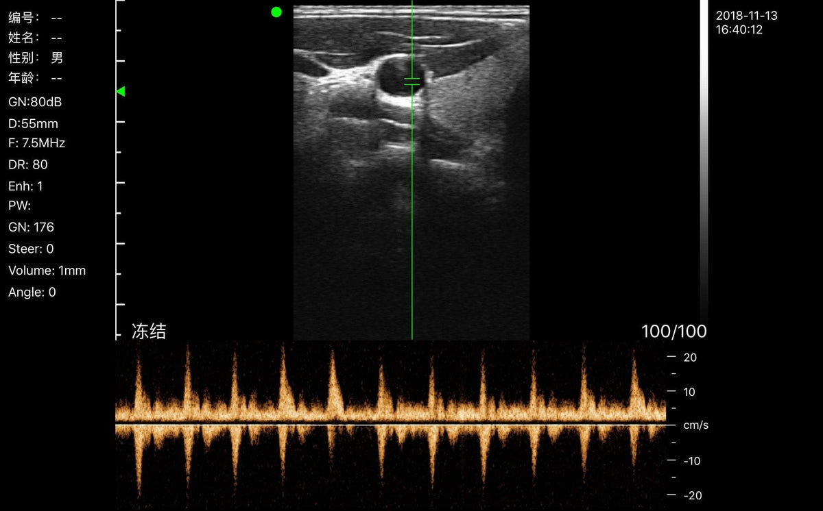 C10MX Pro Color Superfical Ultrasound Linear Probe
