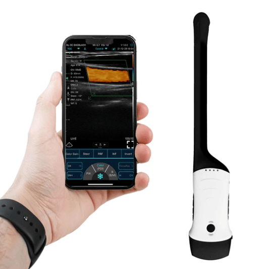 C10RC Dual-probes Multipurpose Ultrasound Convex + Endocavity +Cardiac Probe Real Time Ultrasound