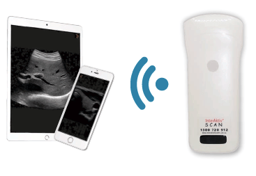 C10RN B&W Abdomen Ultrasound Convex Probe