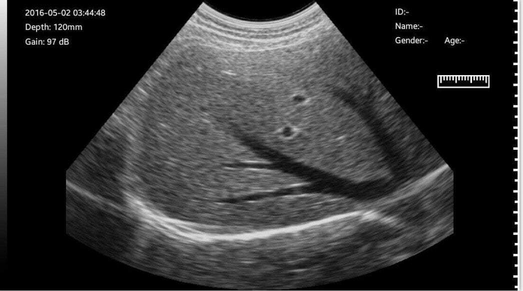 C10RN B&W Abdomen Ultrasound Convex Probe