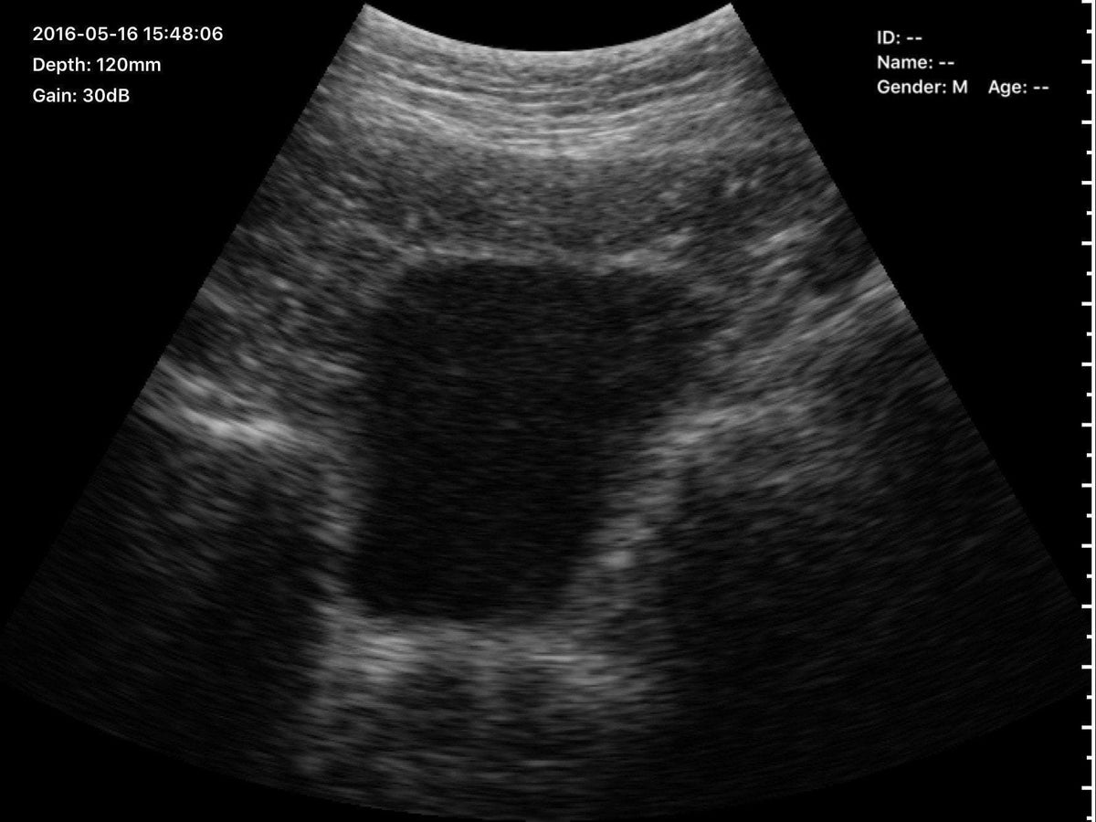 C10RN B&W Abdomen Ultrasound Convex Probe
