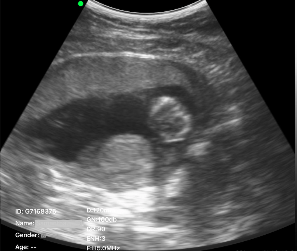 C10RN B&W Abdomen Ultrasound Convex Probe