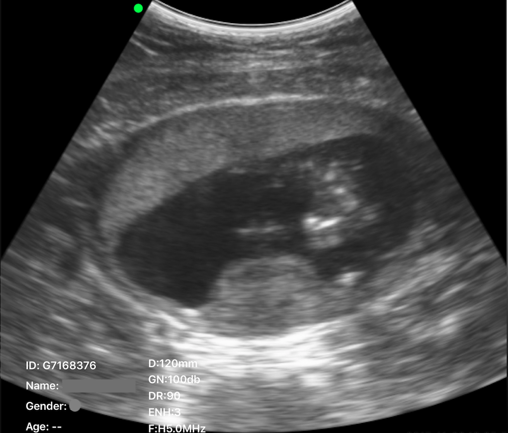 C10RN B&W Abdomen Ultrasound Convex Probe
