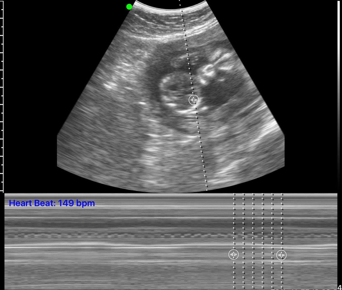 C10RN B&W Abdomen Ultrasound Convex Probe