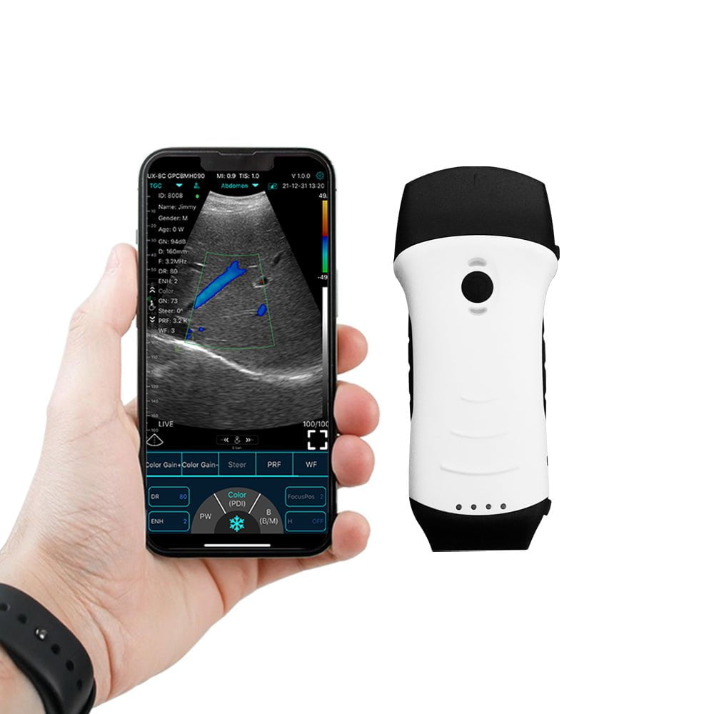 C10TX Dual Head Convex & Linear Wireless Hand Held Ultrasound Machine