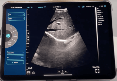 C10TX Dual Head Convex & Linear Hand Held Ultrasound