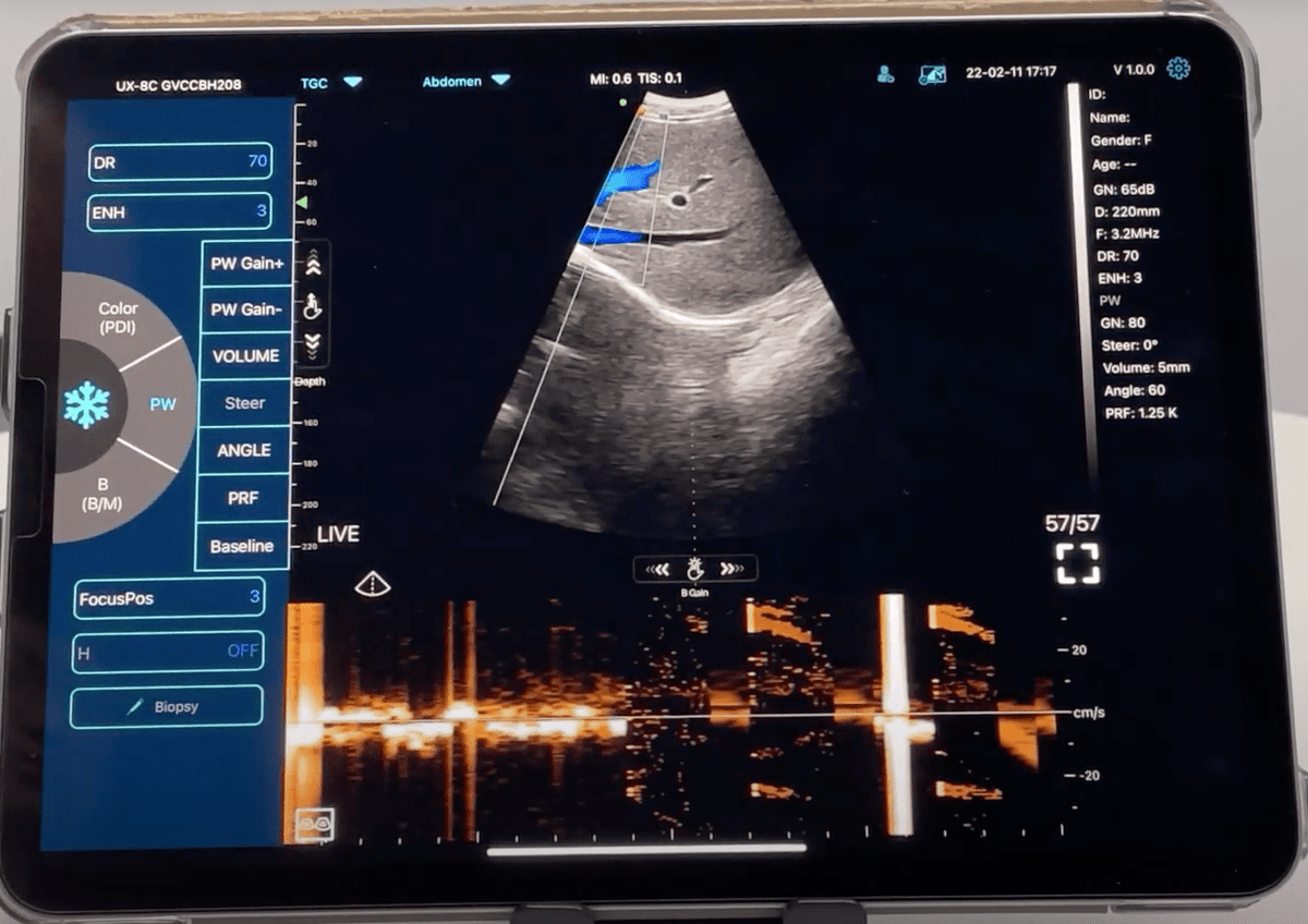 C10TX Dual Head Convex & Linear Wireless Hand Held Ultrasound Machine