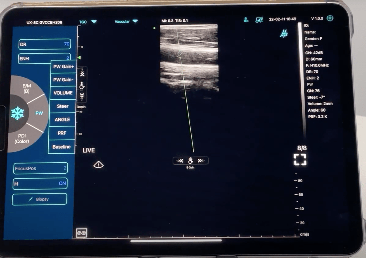 C10TX Dual Head Convex & Linear Wireless Hand Held Ultrasound Machine
