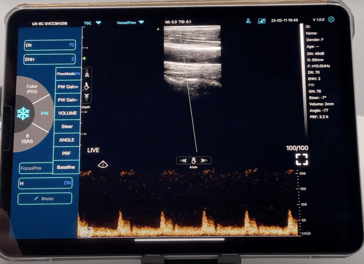 C10TX Dual Head Convex & Linear Wireless Hand Held Ultrasound Machine