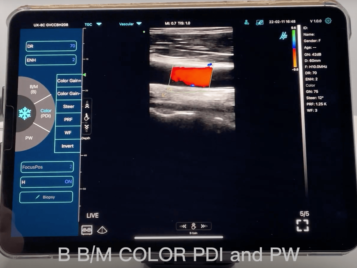 C10TX Dual Head Convex & Linear Wireless Hand Held Ultrasound Machine
