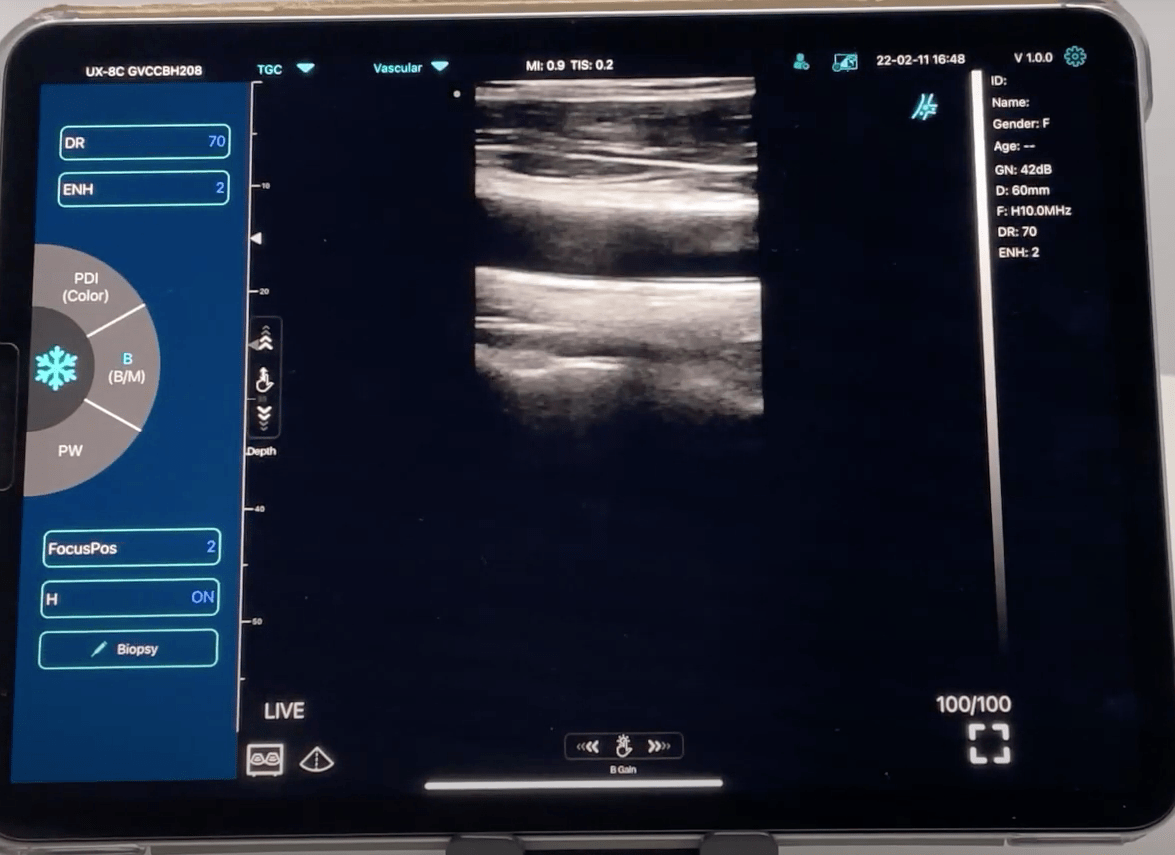 C10TX Dual Head Convex & Linear Wireless Hand Held Ultrasound Machine