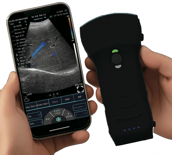 C10TX-PRO Dual Head Convex & Linear Wireless Hand-Held Ultrasound