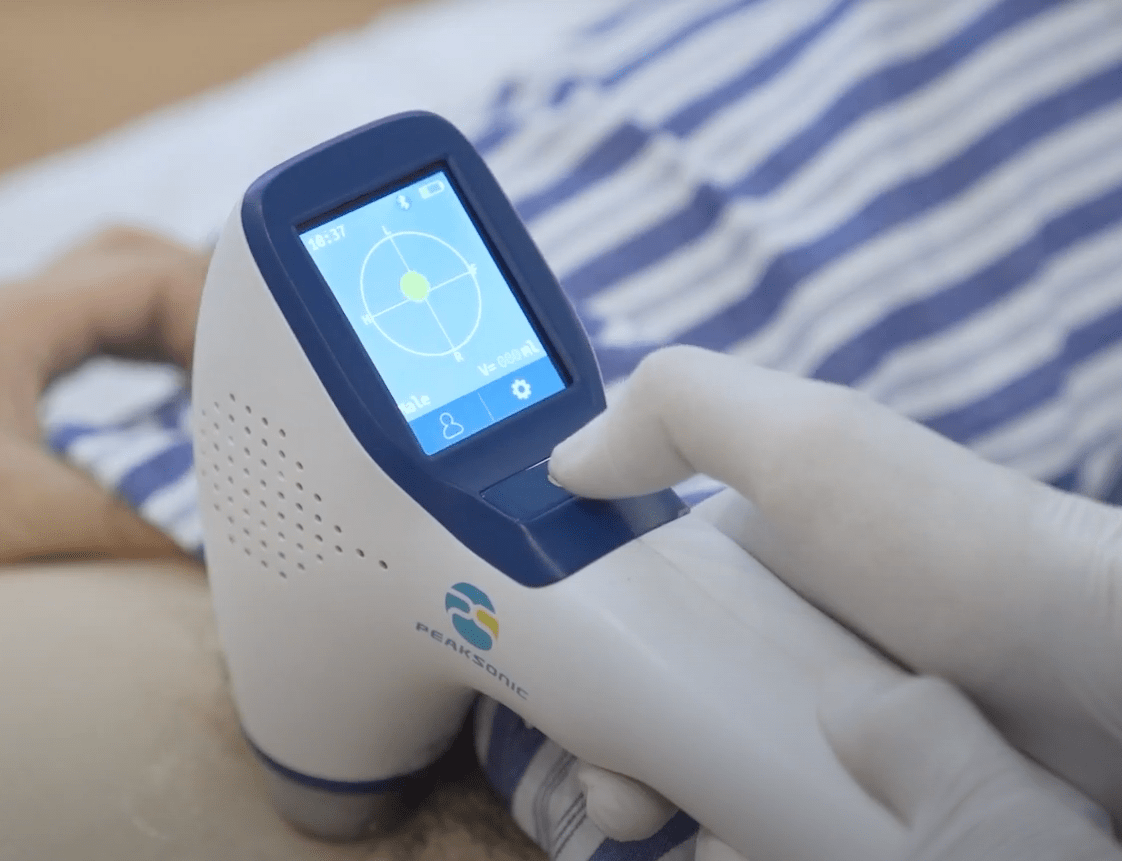 Peaksonic M2 3D Hand-Held Bladder Scanner