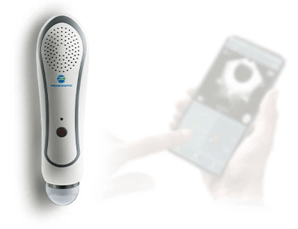 Peaksonic M3 Peaksonic M3 Hand-Held Wi-Fi BladderView Scanner Peaksonic