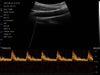 3 in 1 Linear, Convex, Phased Colour Doppler Hand Held Ultrasound with PW