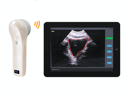 InterAktiv-Scan WiFi Bladder Scanner
