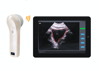 InterAktiv-Scan WiFi Bladder Scanner