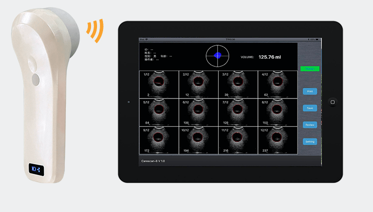 InterAktiv-Scan WiFi Bladder Scanner