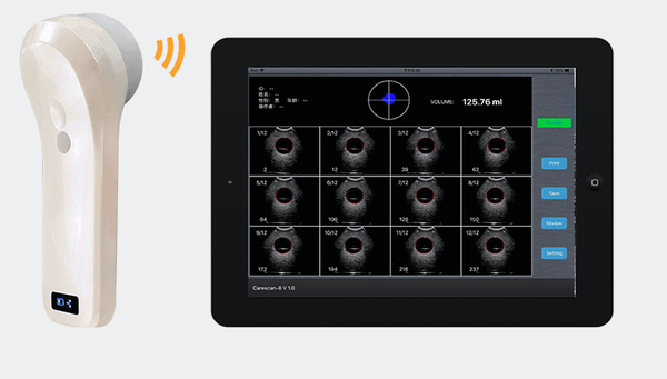 Bladder Scanners | Real Time Ultrasound