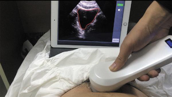 InterAktiv-Scan WiFi Bladder Scanner