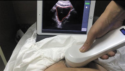 InterAktiv-Scan WiFi Bladder Scanner