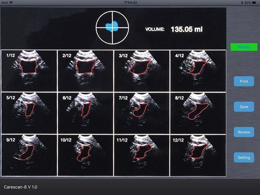 InterAktiv-Scan WiFi Bladder Scanner