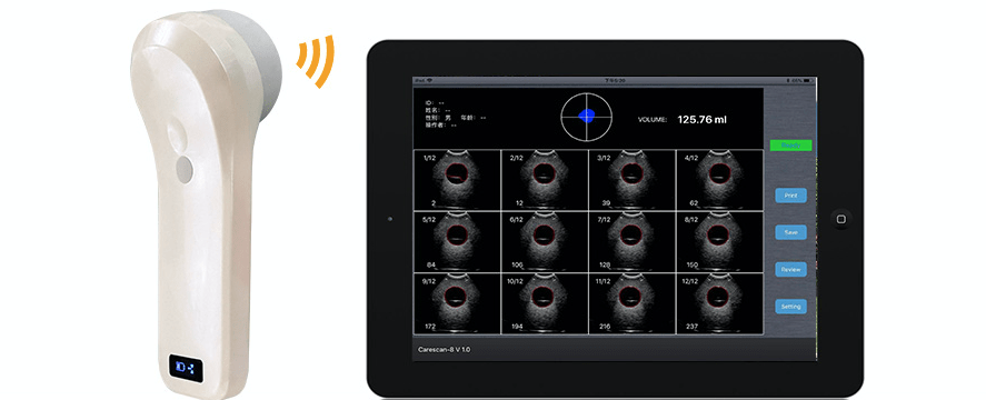 InterAktiv-Scan WiFi Bladder Scanner