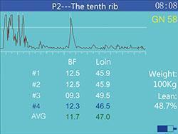 MSU3 Digital Mechanical Sector Ultrasound