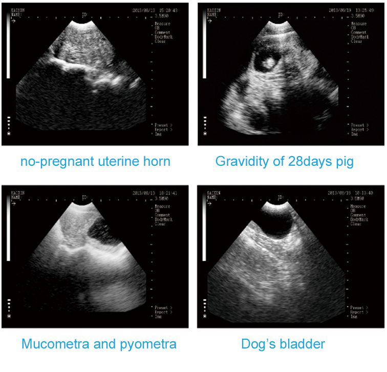 MSU3 Digital Mechanical Sector Ultrasound