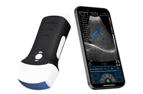 Pocket Realtime Ultrasound Machines