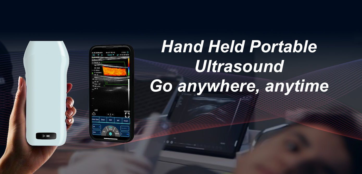 InterAktiv Scan sells Wireless Ultrasound, scanner, Pocket Ultrasound,ultrasound machine,Portable Ultrasound,ultrasound devices for sale,Real Time Ultrasound,veterinary ultrasound price,veterinary ultrasound equipment,Handheld Ultrasound,vet ultrasound,Real Time Ultrasound,Handheld Ultrasound,real time ultrasound machine,ultrasound,scan probe,Buy Ultrasound Machine,doppler ultrasound buy,iphone ultrasound probe,Wireless Ultrasound,Realtime Ultrasound,diagnostic ultrasound for sale,Veterinary Ultrasound,Handheld Ultrasound,Portable Ultrasound,Real Time Ultrasound Machines,Realtime Ultrasound,Pocket Ultrasound
