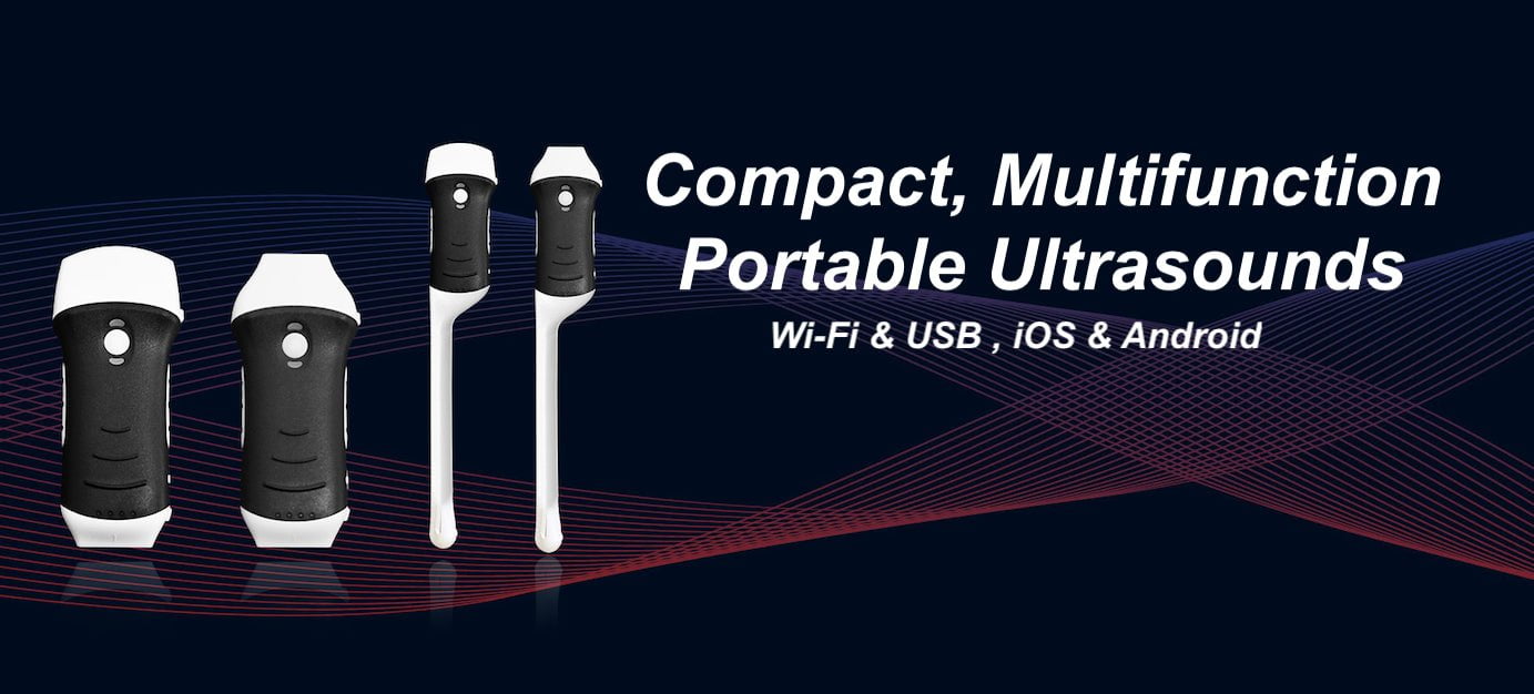 Wireless Realtime Ultrasound Scanner and Bladder Scanners, Portable, Hand Held Ultrasound Scanning Machines